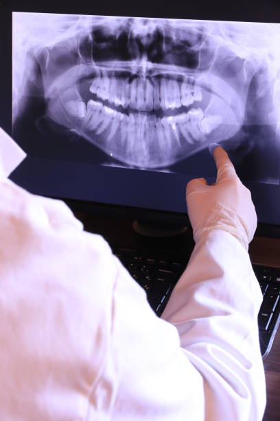 Best Emergency Wisdom Tooth Extraction in Templeton, CA