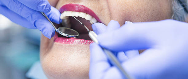 Best Emergency Treatment for Oral Infections in Templeton, CA